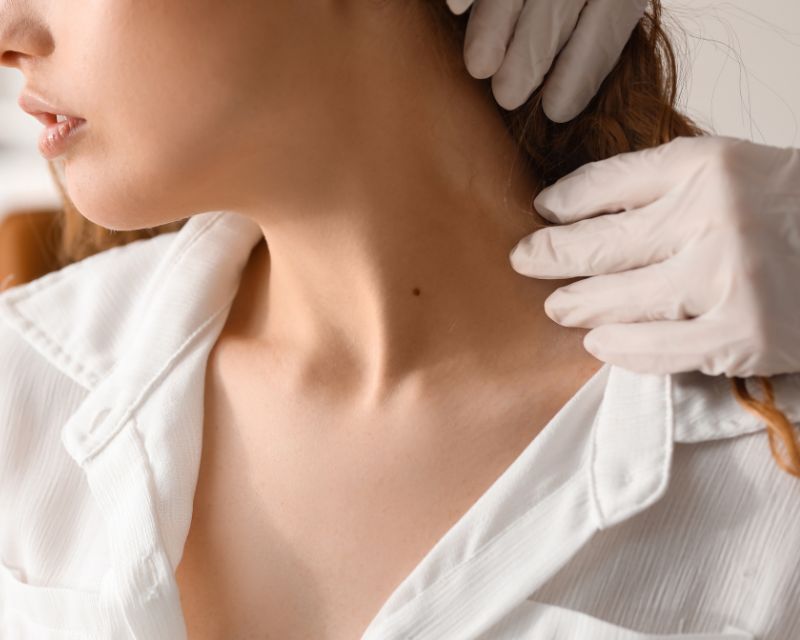 Có nên phá vị trí nốt ruồi ở cổ? Nam nữ cần cân nhắc 3 Việc phá bỏ nốt ruồi ở cổ có ảnh hưởng đến vận mệnh, tài lộc không?