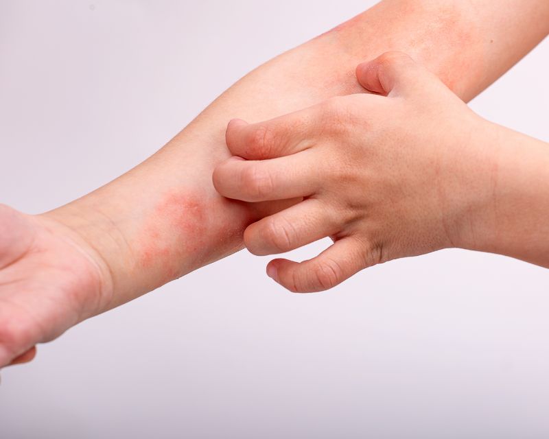 Bạn Đã Biết Khi Nào Cần Bổ Sung Vitamin B6 Chưa? 4 Những triệu chứng thường thấy khi thiếu vitamin B6