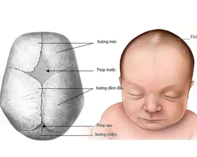 Nhận Biết Hình Ảnh Thóp Trẻ Sơ Sinh Bình Thường Bằng Mắt Thường 2 Thóp trẻ sơ sinh là phần nào trên đầu của trẻ?